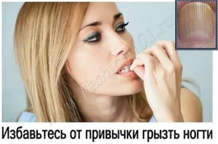 Как избавиться от привычки грызть ногти? кадры Как избавиться от привычки грызть ногти? кадры