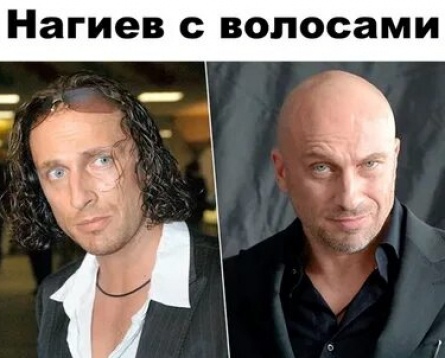 Дмитрий Нагиев стал лысым и толстым кадры