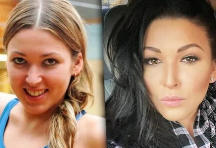 Ирина Дубцова сделала пластику кадры