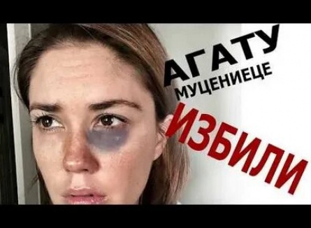 Избитый Прилучный помирился с Муцениеце кадры