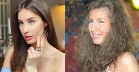 Кэти Топурия увлеклась пластикой кадры