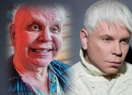 Никто не думал, что болезнь так свалит Моисеева кадры