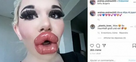 Определена девушка с самыми большими губами кадры