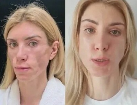 Пластические хирурги изуродовали бабушку Дома 2 кадры