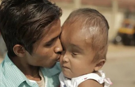 Ребенок с большой головой кадры