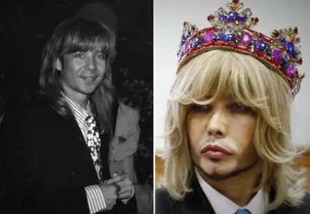 Сергей Зверев сломал плечо кадры