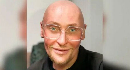 Шура побывал у пластического хирурга кадры