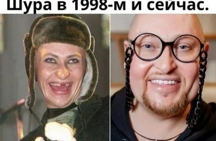 Шура побывал у пластического хирурга кадры
