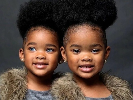 Гены красоты: Топ-7 потрясающих метисов, рожденных от родителей разных национальностей кадры